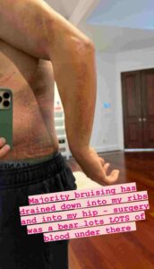 Cody Rhodes lesión actual 