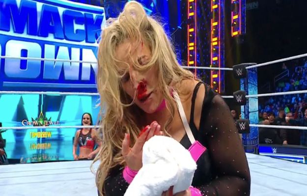 Natalya es operada de una lesión en la nariz