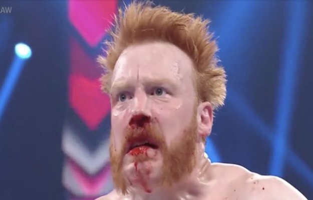 Sheamus revela fotos de operación en la nariz