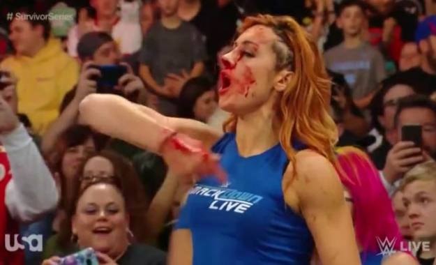 Una Becky Lynch ensangrentada lidera la invasión de WWE RAW