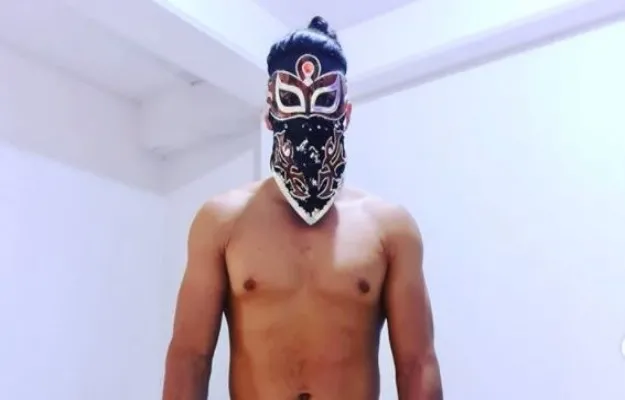 Bandido y las secuelas del Covid-19.JPG Bandido muestra las secuelas en su físico de padecer Covid-19