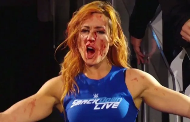 Becky Lynch (1) Becky Lynch