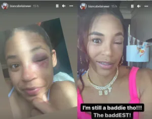 Bianca Belair ojo morado