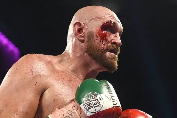 El deseo de Tyson Fury para Wrestlemania