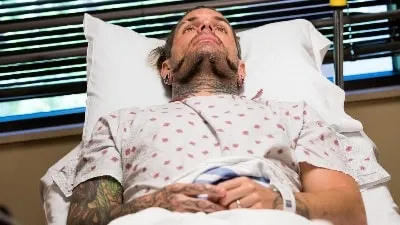 fotos sin censura de la operacion de jeff hardy