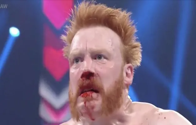 Sheamus Sheamus revela fotos de operación en la nariz