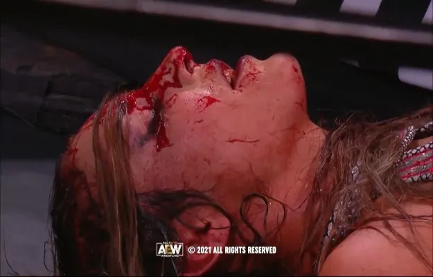 Una lucha callejera en AEW Dynamite